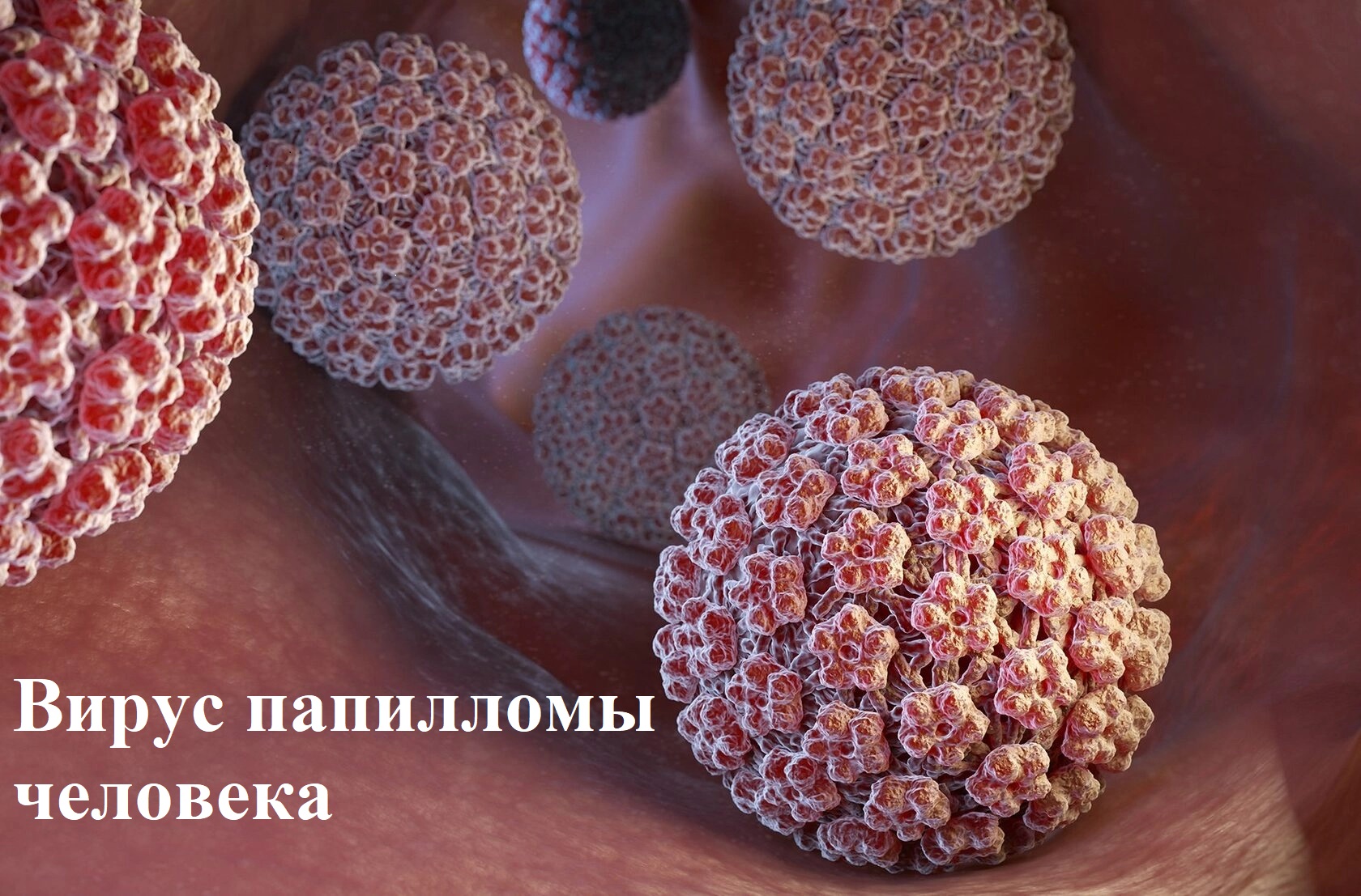 Вакцинация девочек 11 лет против инфекции, вызванной вирусом папилломы человека