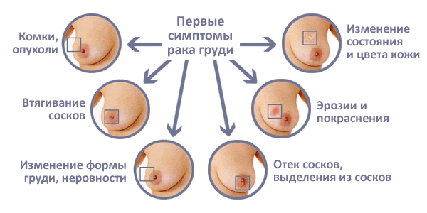 (+70 фото) Фото девушек в лифчике — красивые девушки в бюстгальтере